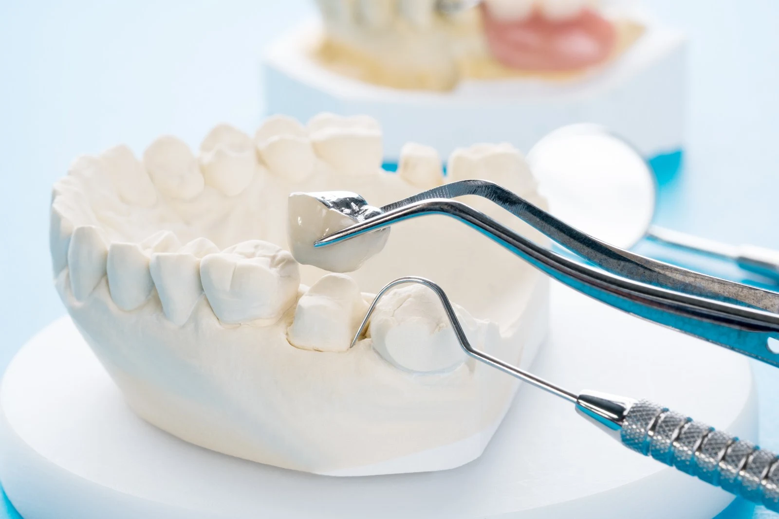 Dental Crowns in Blue Bell