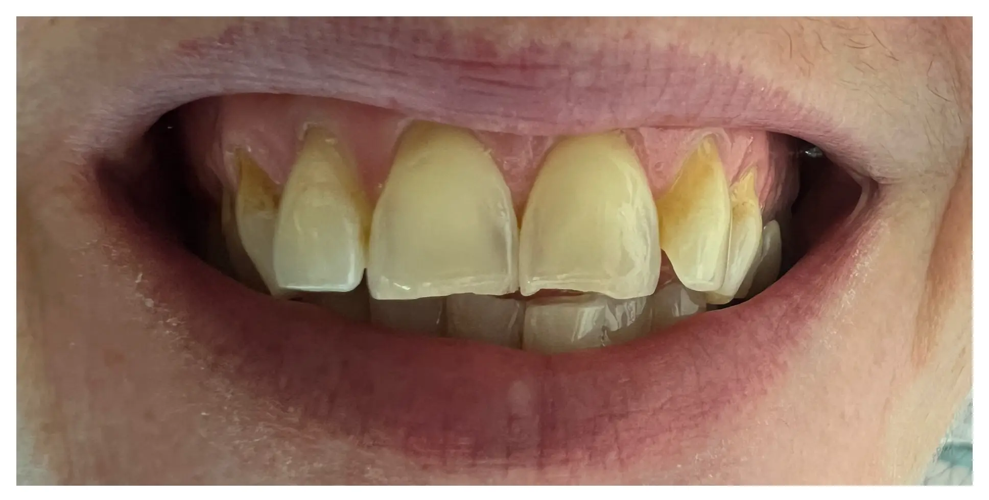 Before Image