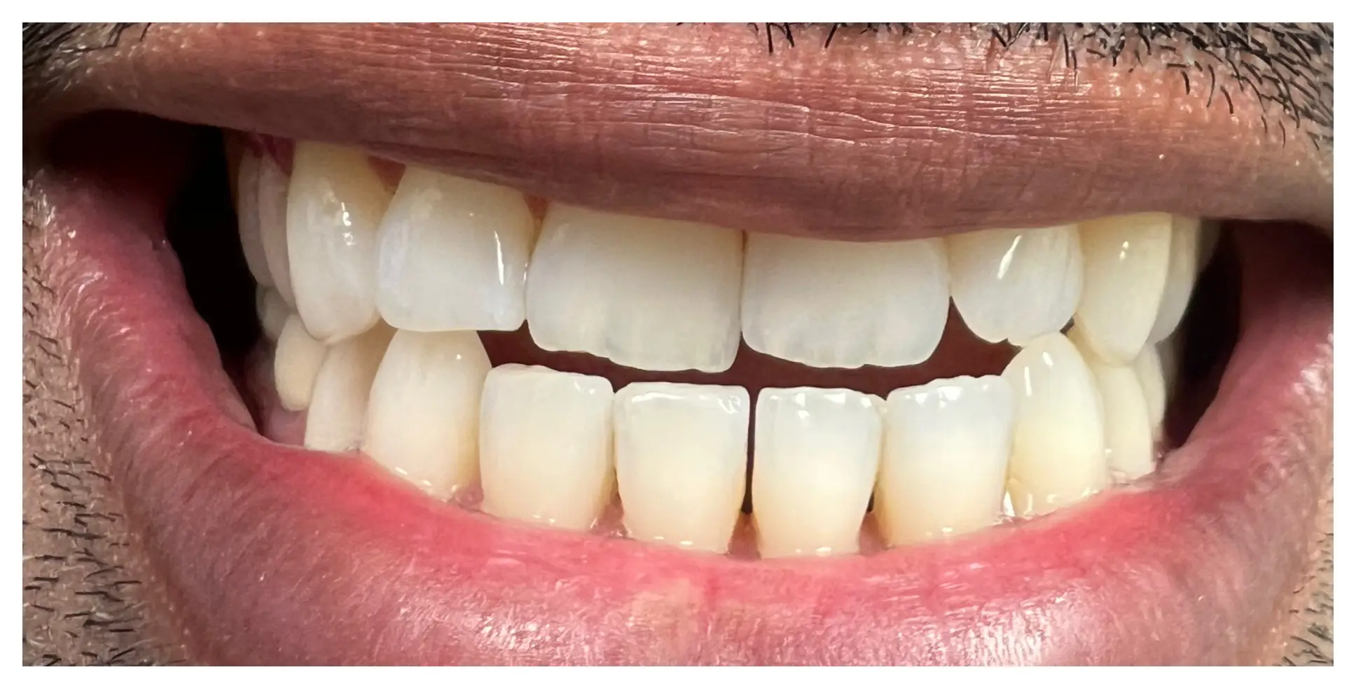 Before Image