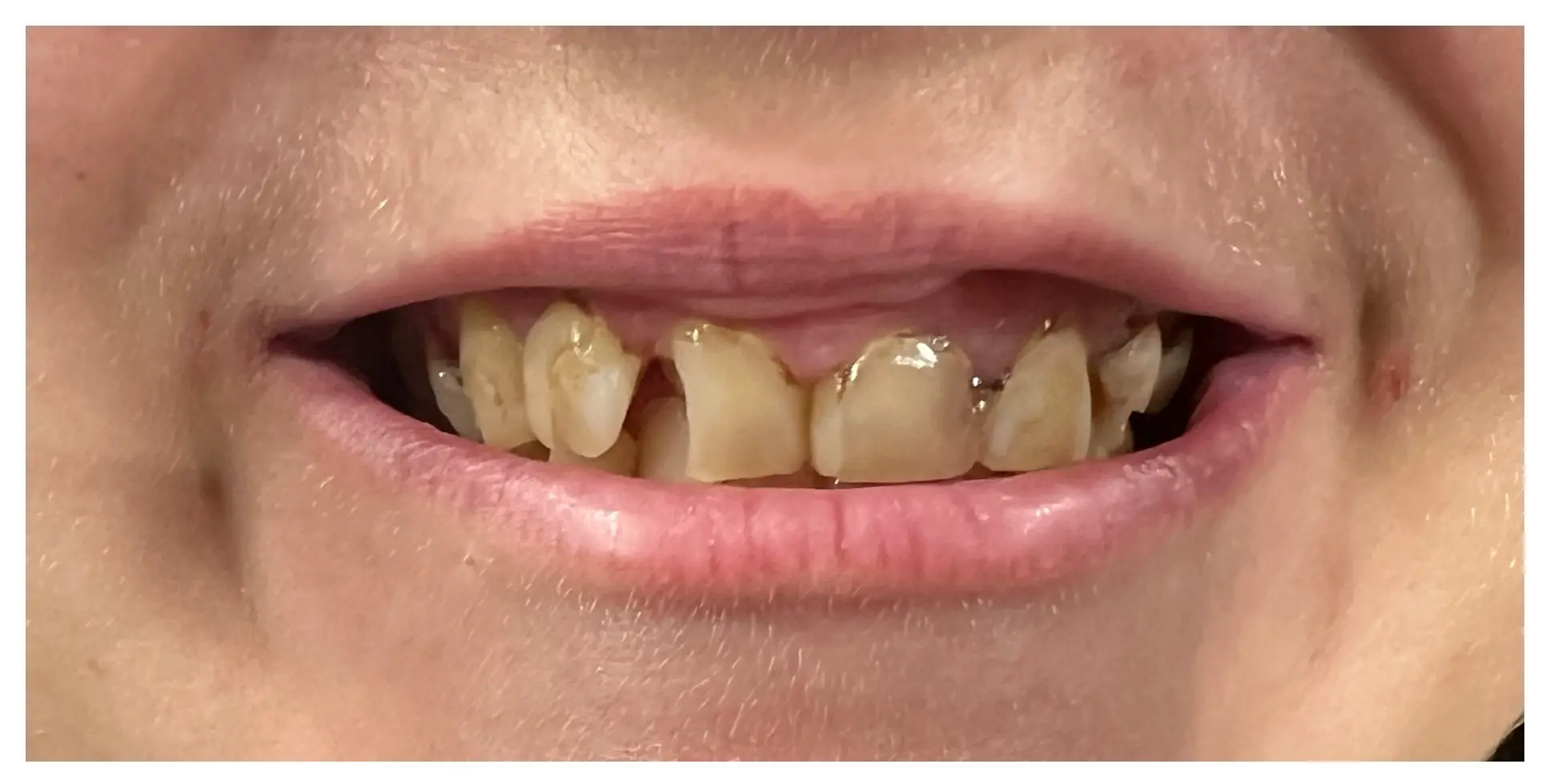 Before Image