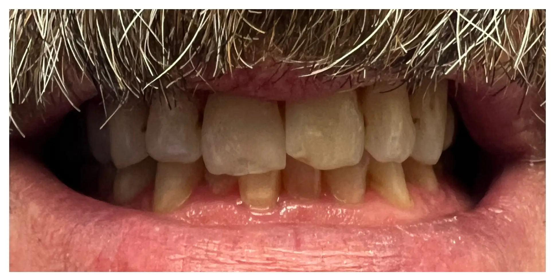Before Image