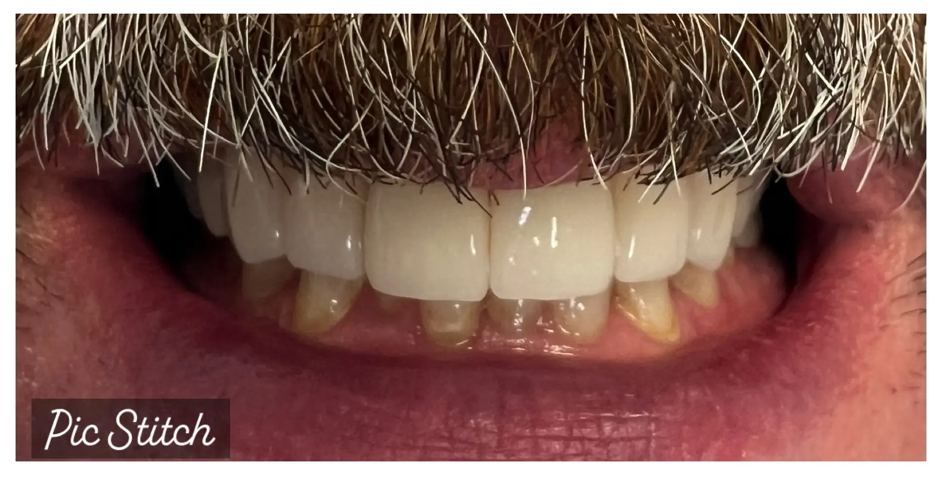 After Image