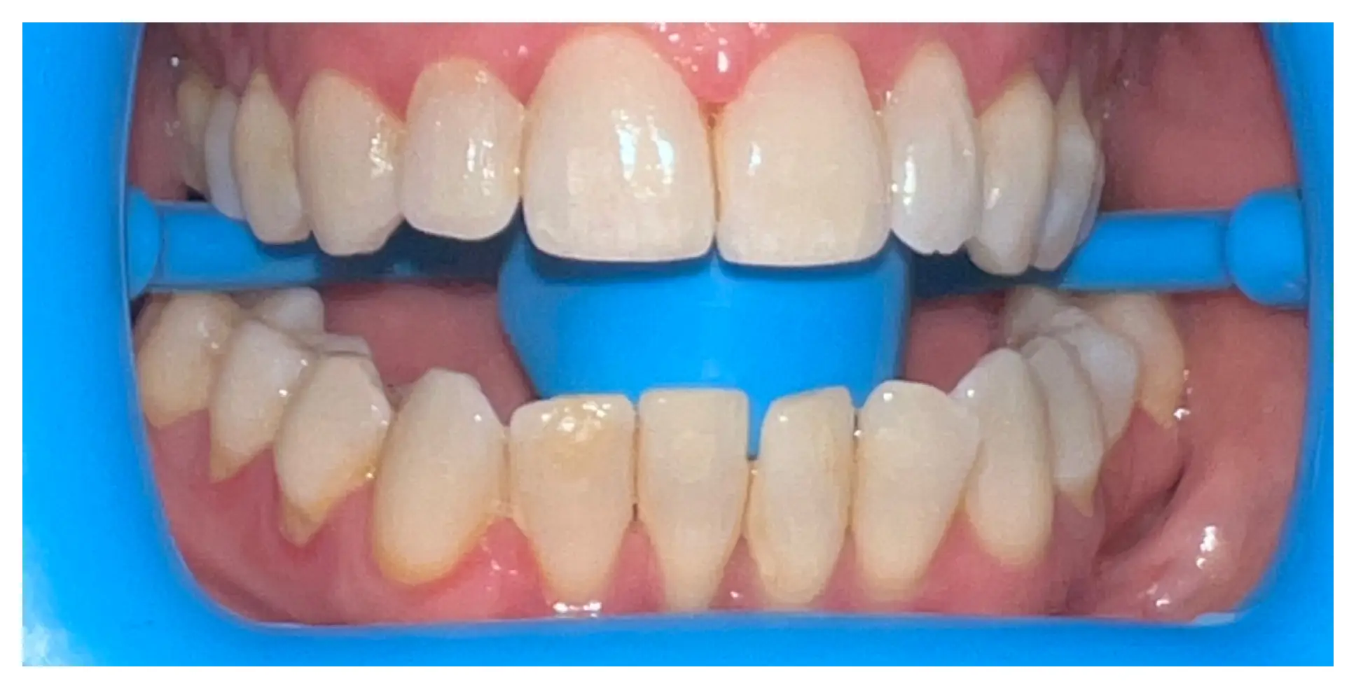 Before Image