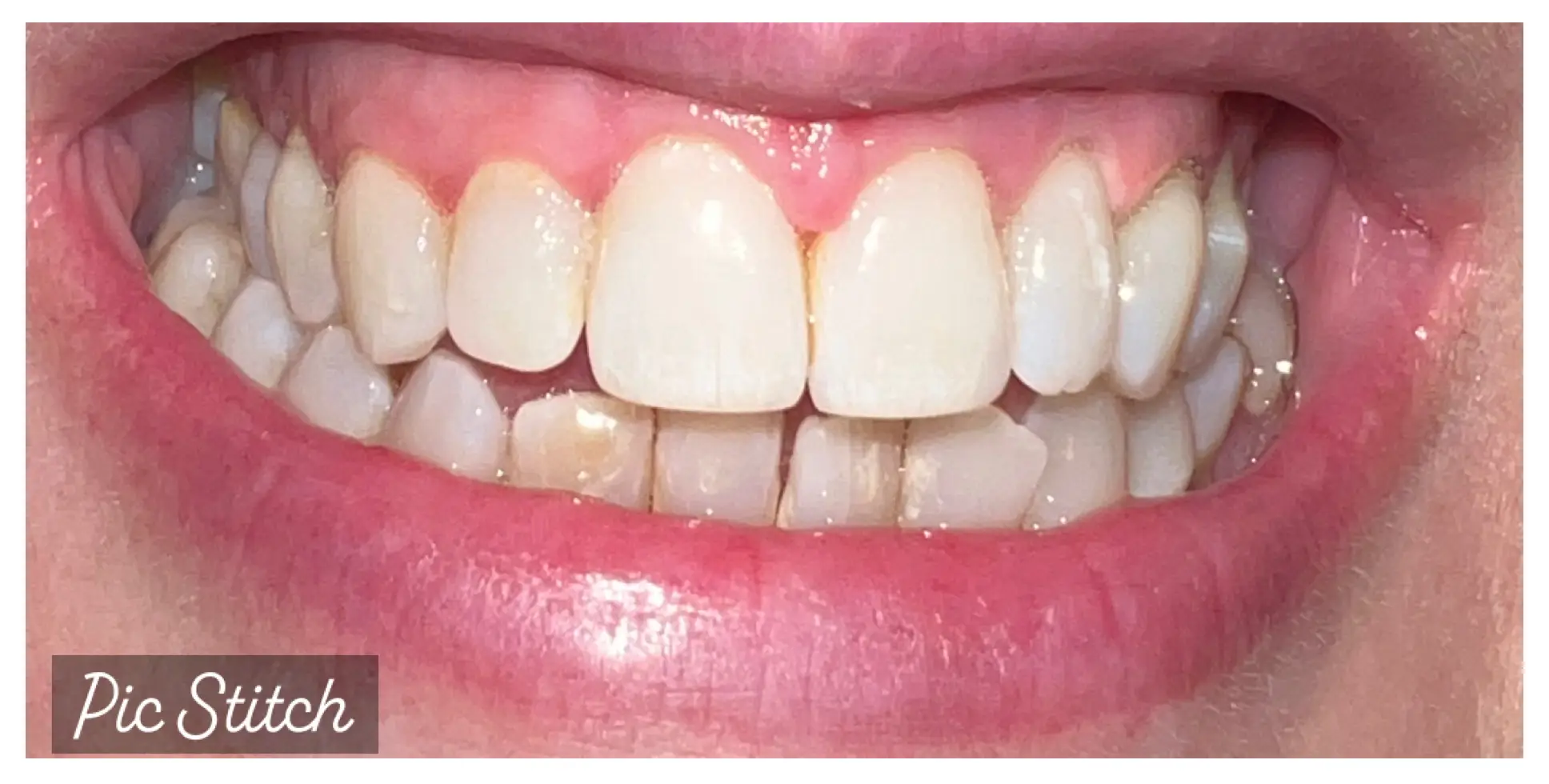 After Image