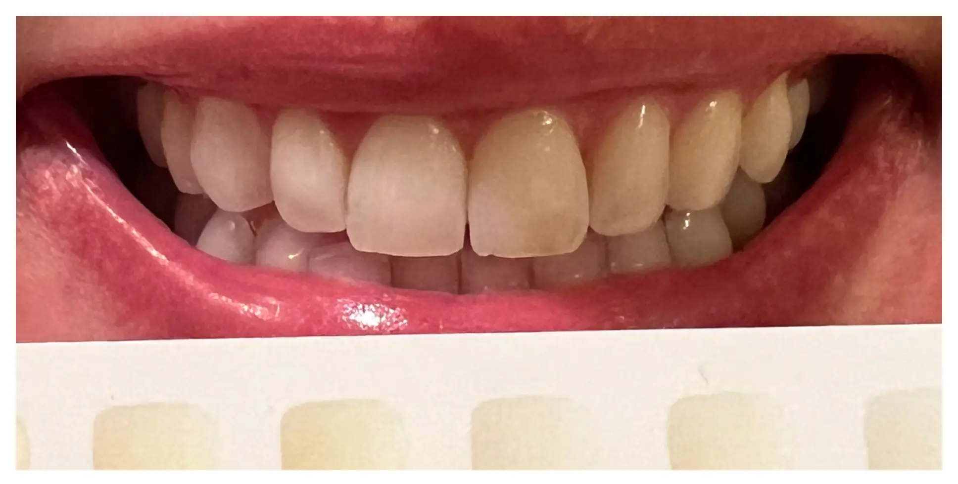 Before Image