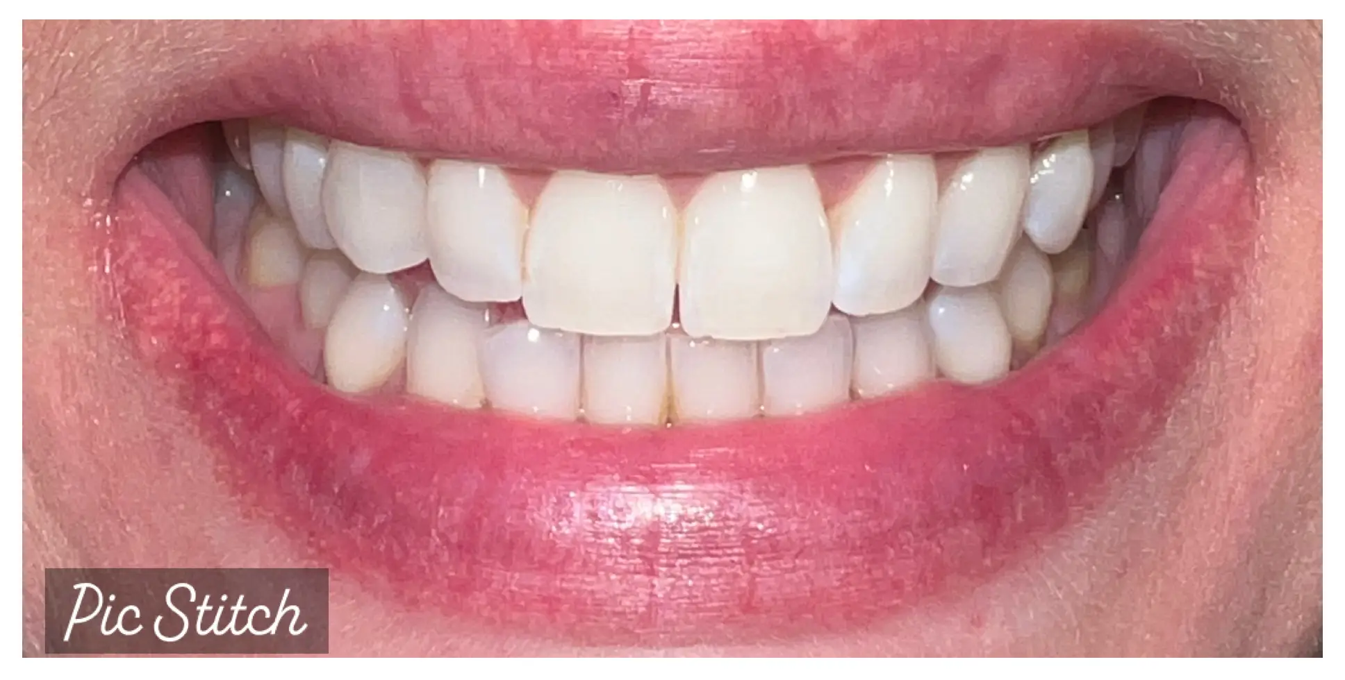 After Image
