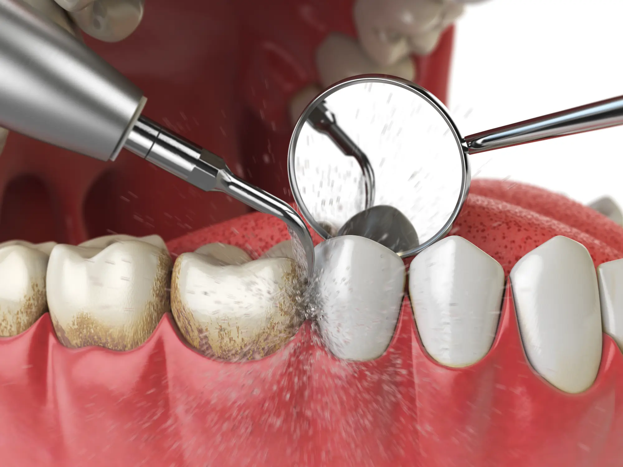 Dental Cleanings in Blue Bell | Rituals Dental Wellness & Aesthetics